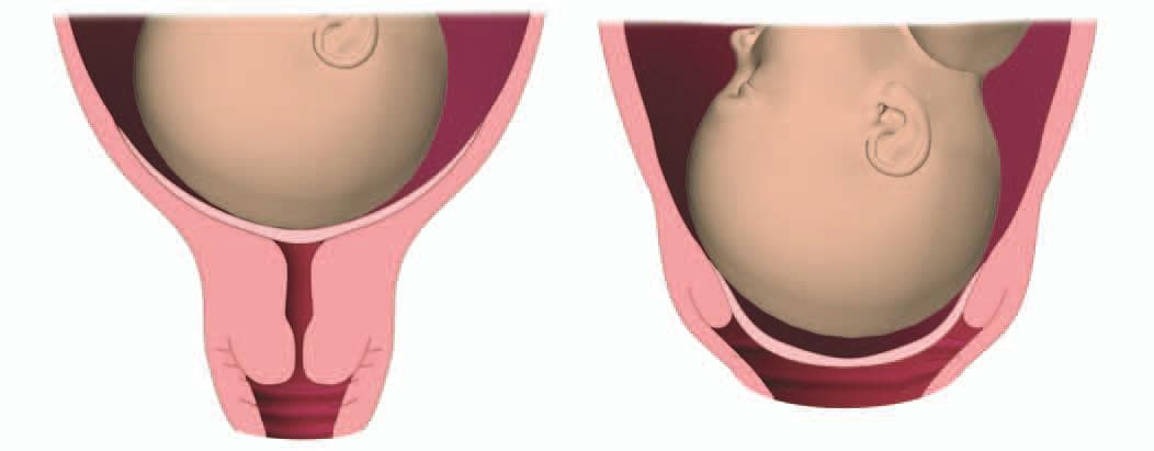 Раскрыта ли. Раскрытая шейка матки крупным планом. Dilatation of the cervix of the pregnant Cow.